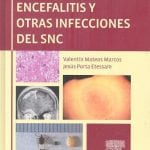 Meningitis Encefalitis Y Otras Infecciones - Elsevier