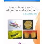 Manual De Restauración Del Diente Endodonciado - Ergon