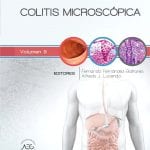 Colitis Microscópica - Fernández-bañares Fernando - Elsevier