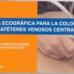 Guía Ecográfica Para La Colocación - Blázquez Jose - Ergon