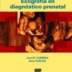 Ecografía En Diagnóstico Prenatal - Carrera J.m - Elsevier