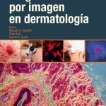 Diagnóstico Por Imagen En Dermatología - Elsevier