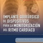 Implante Quirúrgico De Dispositivos - Poole - Elsevier