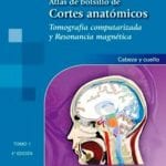 Atlas Bolsillo Cortes Anatómicos T 1 / Moller - Panamericana