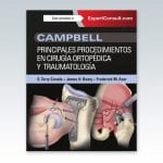 Campbell Principales Procedimientos - Canale - Elsevier
