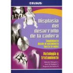 Displasia Del Desarrollo De La Cadera / Malagon / Celsus