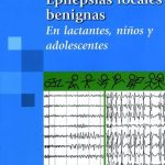 e-book Epilepsias Focales Benignas - Panamericana