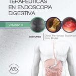 Innovaciones Terapéuticas En Endoscopia Digestiva - Elsevier