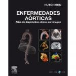 Enfermedades Aórticas - Hutchison S. - Elsevier