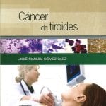 Cáncer De Tiroides - Gómez José - Elsevier