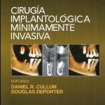Cirugía Implantológica Mínimamente - Cullum Daniel - Elsevier