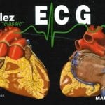 Ecg Electrocardiografía - Vélez Desiree - Marban
