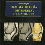Radiología En Traumatología - Pedrosa Cesar - Marban