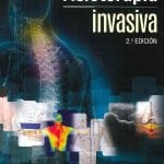 Fisioterapia Invasiva - Valera Fermín - Elsevier
