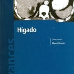 Avances En Diagnostico Por Imagenes Higado - Miguel - Journal