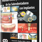 Manual Clínico y de Laboratorio de las Sobredentaduras con Implantes / Hamid R. Shafie / AMOLCA