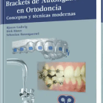 Brackets de Autoligado en Ortodoncia /  Bjoern Ludwig / AMOLCA