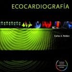 Ecocardiografía - Roldán Carlos - Lippincott