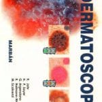 Dermatoscopia - Johr Robert - Marban