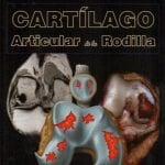 Cartilago Articular De La Rodilla - Sanchez Miguel - Marban