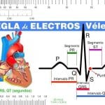 Regla De Electros Vélez - Vélez - Marban