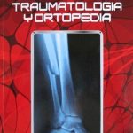 Conceptos En Traumatologia Y Ortopedia 3ra Edición - Celsus