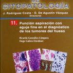 Cuadernos De Citopatología Tomo 11. Punción Aspiración Con Aguja Fina En El Diagnóstico De Los Tumores - Díaz De Santos
