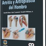 Artritis Y Artroplastia Del Hombro - David Diner / Amolca