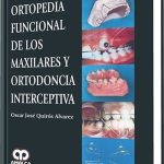 Ortopedia Funcional De Los Maxilares Y Ortodoncia Interceptiva - Quiros - Amolca