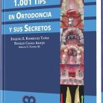 1001 Tips En Ortodoncia Y Sus Secretos - Esequiel Rodriguez / Amolca