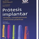 Prótesis Implantar - Ezio Bruna / Amolca