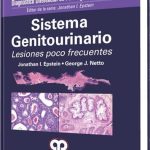 Diagnóstico Diferencial en Patología Quirúrgica Sistema Genitourinario / Jonathan Epstein / AMOLCA