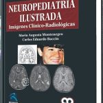 Neuropediatría Ilustrada. Imágenes Clínico-Radiológicas / AMOLCA