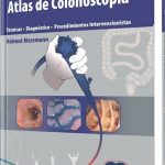 Atlas de Colonoscopia / Helmut Messmann / AMOLCA