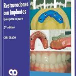 Restauraciones con Implantes, Guía Paso a Paso  / Carl Drago / Amolca