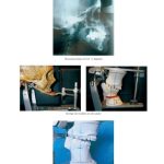 Oclusión Orgánica y Ortognatodoncia / Erik Martínez  - Alfonso Fernández / AMOLCA