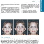 Compendio de Cefalometría  / Carlos Zamora / AMOLCA