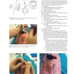 Técnicas Quirúrgicas en Laringología / Clark A. Rosen - C. Blake Simpson / Amolca