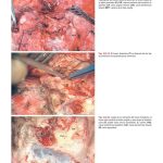 El Nervio Facial en la Microcirugia del Hueso temporal / Mario Sanna / Amolca