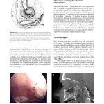 Cirugía Endoscópica Sinusal / Peter-John Wormald / AMOLCA