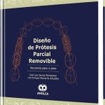 Diseño de Prótesis Parcial Removible Secuencia Paso a Paso / José Luis García Micheelsen / AMOLCA