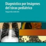 Diagnóstico Por Imagenes Del Tórax Pedíatrico 2da Edición - Journal