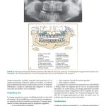 Radiografía Dental  / Lannucci - Jansen Howert / AMOLCA