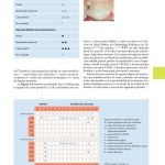 Manejo de la Caries / Hendrik Meyer-Lueckel / AMOLCA