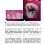 Microbiología Oral / Philip Marsh / AMOLCA