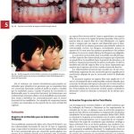 Tratamiento Ortodóncico y Ortopédico Dentofacial / Thomas Rakosi / AMOLCA