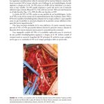 Función y Cirugía de las Arterias Carótida y Vertebrales / Ramon Berguer / AMOLCA