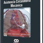 Asistencia Circulatoria Mecánica / Joyce - Loebe / AMOLCA