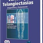 Várices y Telangiectasias Diagnóstico y Tratamiento / Ivanésio Merlo / AMOLCA