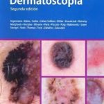 Dermatoscopia 2da Edición - Journal